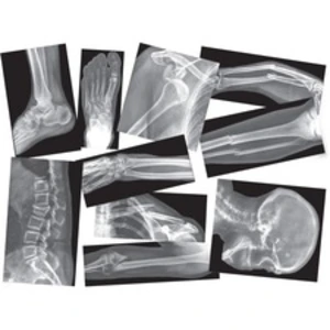 Roylco RYL R5914 Roylco Broken Bones X-rays Set - Themesubject: Radiol