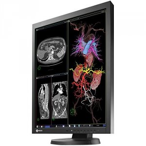 Eizo MX215-BK 21.3in Lcd 1500:1 2mp 1600x1200 Medical Radiforce Mx215-