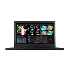 Lenovo 20EN0013US Topseller P50 I7-6700hq 2.6g 8g